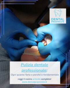 Pulizia Dentale professionale in azione