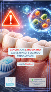 Gengive che sanguinano, rappresentazione digitale