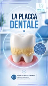 Placca dentale rappresentata graficamente