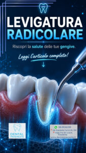 immagine di dente, gengiva e strumento per la Levigatura radicolare