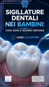Immagine che mostra una sigilllatura dentale per bambini